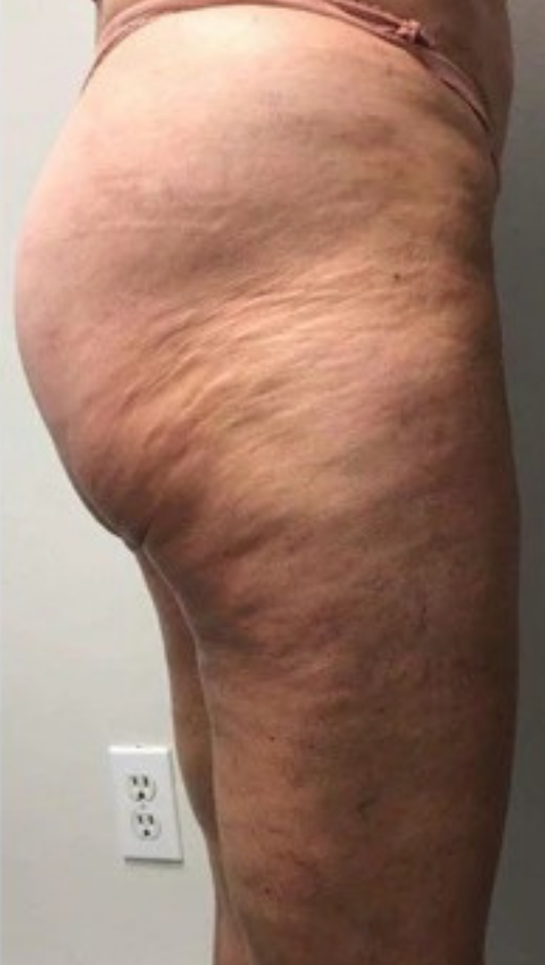 Résultat