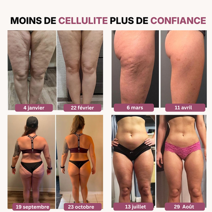 SlimFit I Réduisez visiblement la cellulite à chaque mouvement